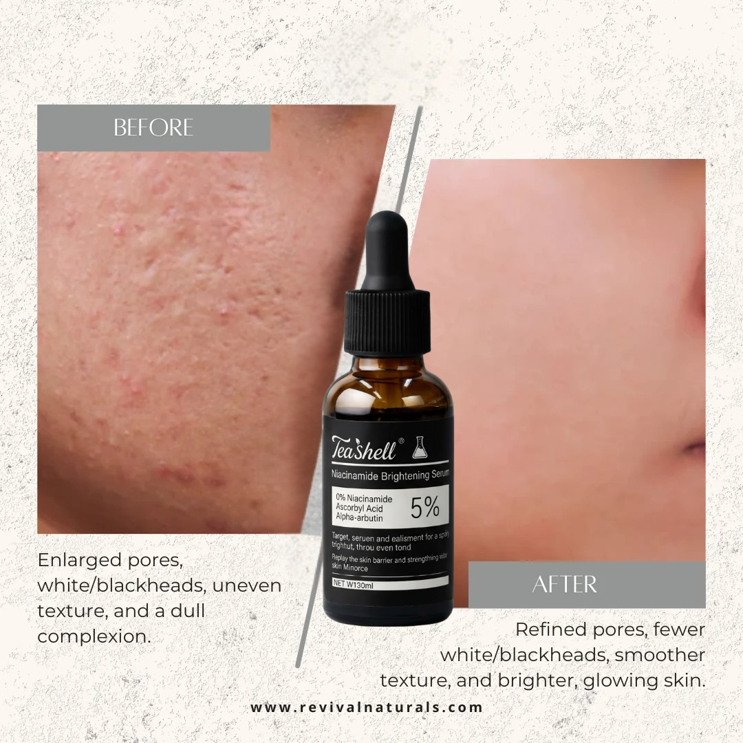 Teashell Niacinamide Brightening Serum | 5% Niacinamide + Alpha-Arbutin + Ascorbyl Acid | Fades Dark Spots, Evens Skin Tone & Boosts Glow (Buy 1 Get 1 Free)