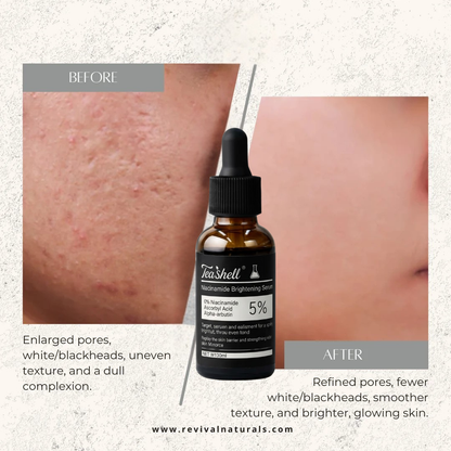 Teashell Niacinamide Brightening Serum | 5% Niacinamide + Alpha-Arbutin + Ascorbyl Acid | Fades Dark Spots, Evens Skin Tone & Boosts Glow (Buy 1 Get 1 Free)