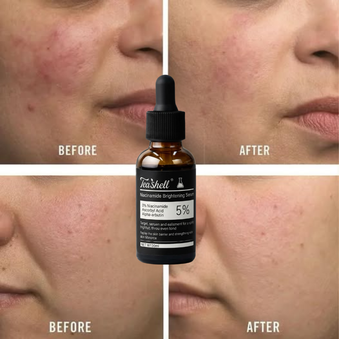 Teashell Niacinamide Brightening Serum | 5% Niacinamide + Alpha-Arbutin + Ascorbyl Acid | Fades Dark Spots, Evens Skin Tone & Boosts Glow (Buy 1 Get 1 Free)