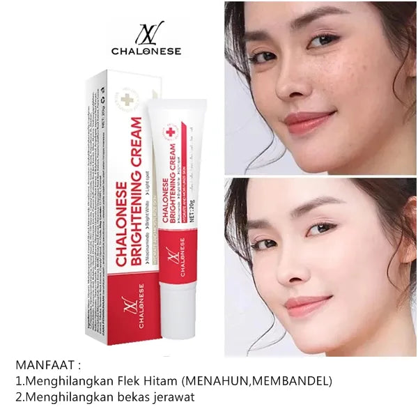 Chalonese Brightening Cream – Buy 1 Get 1 Free | Anti Pigmentation & Acne Marks Cream | 1350 PKR