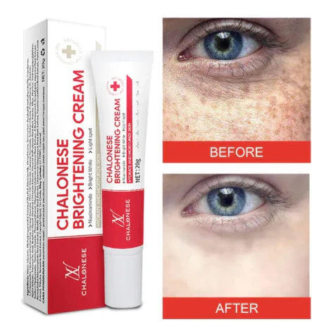 Chalonese Brightening Cream – Buy 1 Get 1 Free | Anti Pigmentation & Acne Marks Cream | 1350 PKR