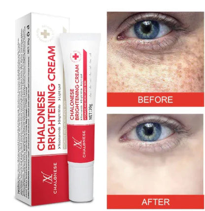 Chalonese Brightening Cream – Buy 1 Get 1 Free | Anti Pigmentation & Acne Marks Cream | 1350 PKR
