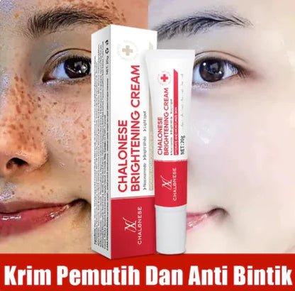 Chalonese Brightening Cream – Buy 1 Get 1 Free | Anti Pigmentation & Acne Marks Cream | 1350 PKR