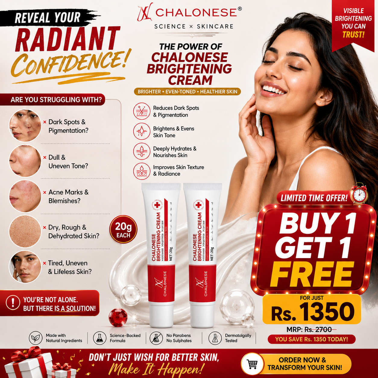 Chalonese Cream | Anti Pigmentation & Acne Cream