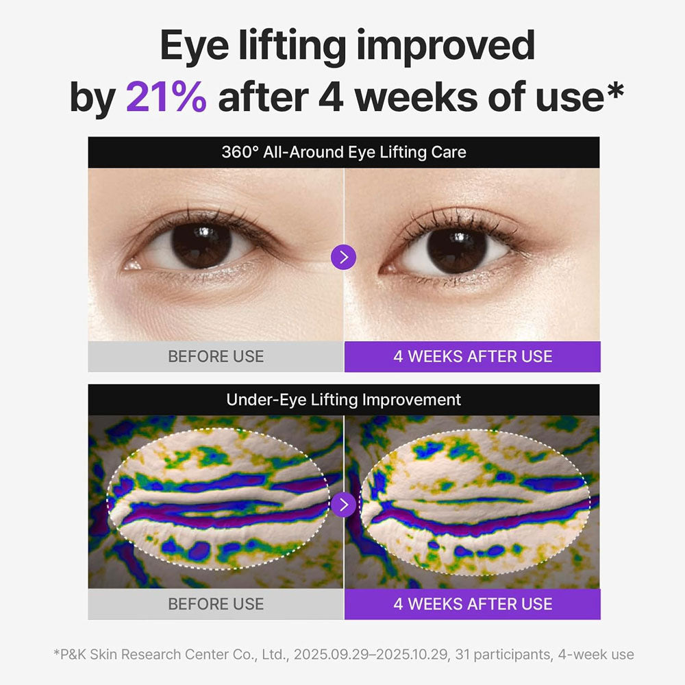 Centellian24 360º Shot PDRN Lifting Eye Cream 30ml (Buy 1 Get 1 Free)